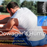 Dowager’s Hump: Symptoms, Cure, and Prevention
